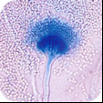 Name this image in a
Lactophenol blue stain