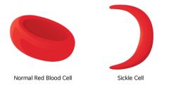anemia: deficiency of red blood cells or 
hemoglobin

more prominent in Africa and Middle East