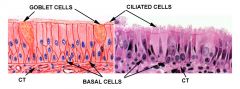 1. respiratory epithelial cells (columnar, pseudostratified and ciliated)
2. Goblet cells
3. Neuroendocrine cells
4.Basal cells (respond to injury by migrating upwards)