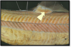 Dogfish -- Identify this group of muscles