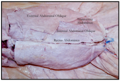 external abdominal oblique