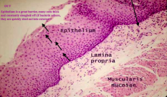 Esophagus:
- Epithelium is stratified squamous and constantly sloughing off
- If bacteria adhere to epithelium, they are quickly sloughed before they can get in
- Purple dots in Lamina Propria are neutrophils, macrophages, and lymphocytes (phys...
