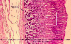 Stomach:
- Immune cells are littered throughout the lamina propria (a lot more of these immune cells near the epithelial surface and less near the submucosal surface)