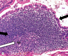 What is this an image of in the ileum?