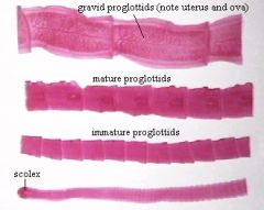 tapeworm


 


gravid proglottids have uterus and ova while mature proglottids doesn't 


 


gravid proglottids is nearest to scolex


 


obtain food across body surface