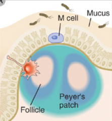 Peyer's Patch
- Left black arrow: Parafollicular cortex (darker, contains T cells)
- White arrow: Germinal center (lighter, contains B cells)
- Right black arrow: Follicle Associated Epithelium (in close association with the Peyer's patch so th...