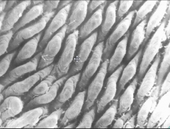 These are intestinal villi! broad, leaf-shaped, packed together

the are moving up and down! and there is a central lacteal in the middle that helps it move. Called a "lacteal" because after a fatty meal these become REALLLL fat and looks WHITE!...