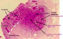 AppendixAppendix
- Has a colonic like epithelial surface
- Crypts but no villi
- Immune cells in the lamina propria
- Lymph follicles underneath epithelium contains germinal center (light w/ B cells) and parafollicular cortex (dark w/ T cells)