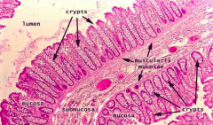 Colon:
- Crypts but no villi
- Basal level of immune cells in lamina propria
- Physiologically inflamed immune tissue (not infected)