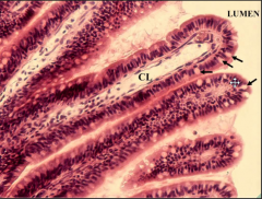Cells at the pointer that are leached out are "goblet cells" 

Simple columnar epithelial!