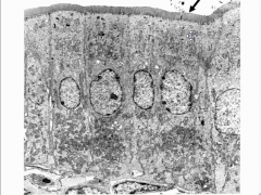 Nuclei of adjacent intestinal absorptive cells. The borders are interdigitating.