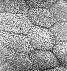 Cells are hexagonal or pentagonal - see microvillus brush border (SEM!)