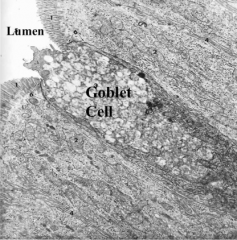 Goblet Cell