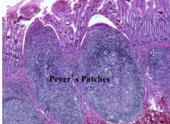 Peyer's Patches