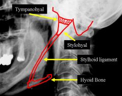 there are many, but here is the stylohyoid ligament and muscle