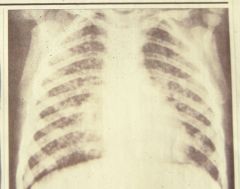 What is this an x-ray of?