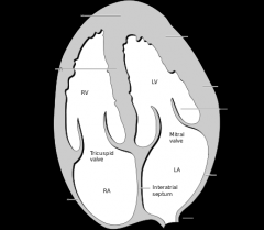  


Leaflet closest to RV is anterior