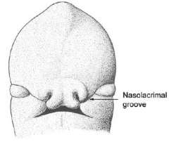 It separates the maxillary and lateral nasal prominences.

- ectoderm of groove's floor forms a cord, which canalizes to form the nasolacrimal duct (connects lacrimal sac to inferior meatus of nasal cavity)