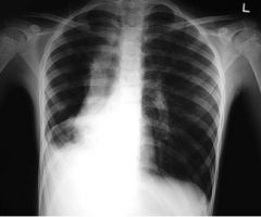 What is this an x-ray of and how can you tell?