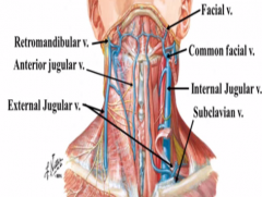 What is special about a jugular vein injury?

how could it kill you?