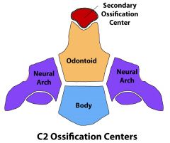 The CT scan shows a fused basilar synchondrosis with a C2 secondary ossification center that is not yet fused. Therefore the patient is most likely 8-10 years of age.

The axis (C2) develops from five ossification centers. These include the body...