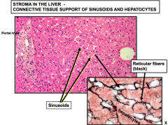 Sinusoids 


Reticularwalls (collagen type III) support walls of discontinous capillaries 


(Whiteis the lumen of the sinusoids)