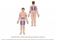 Back of arm, stomach  (2 inches away from umbilicus-- muffin top), subscapular, quad area
