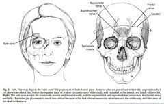 1-Weak in biting &chewing strengt; 2-Deficit in med & downward eye movmt; 3-Deficit in lat eye movmt 
4-Inability to close eyes against resistance; 5-Tongue deviation toward the affected side::: pt w/ Type II odontoid fx. CN VI palsy MC nerve pal...