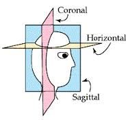 Cut right down the middle of the brain.


ex: mid sagittal, 
paralateral-next to the mid line/mid sagittal