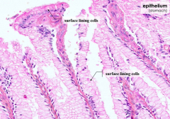 Surface lining cells = simple columnar epithelium