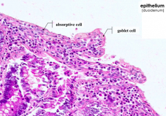 Absorptive cells (enterocytes) and goblet cells = simple columnar epithelium