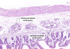 Presence of submucosal glands of Brunner