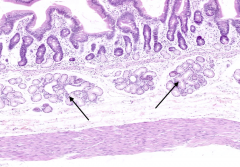 What are the arrows pointing out in the duodenum?
