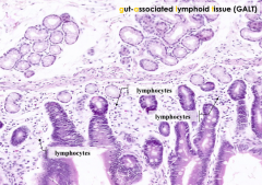 GALT: Gut-Associated Lymphatic Tissue