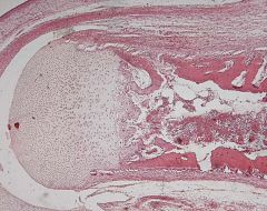 Anzahl der Knorpelzellen: viele, aber noch keine Chondrone ausgebildetKann Blutgefäße enthaltenKollagenfibrillen maskiert (bild: fetaler knorpel epiphyse)