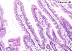Are goblet cells present in the mucosal epithelium? Where?