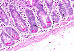 What is this cell type pointed out by the arrows?