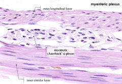 Myenteric (Auerbach's) Plexus in between the layers of the muscularis externa