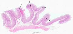 Plicae Circulares (valves of Kerckring)
- Folds have submucosa as their core 
- Villi project from the surface
- Muscularis externa lies deep to the folds