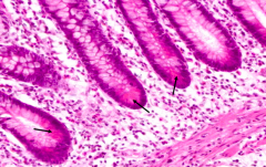 Paneth Cells