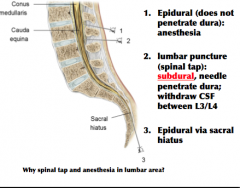 Epidural and lumbar puncture