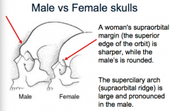 Male vs Female skulls