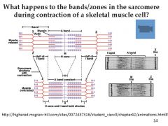 What happens to the bands/zones in the sarcomere during contraction of a skeletal muscle cell?