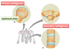 Which of the following are examples of a cartilaginous joint?
a. The epiphyseal plate in a long bone
b. Intervertebral discs in the vertebral column
c. The sutures between the bones of the skull
d. All of the above
e. Only A and B
