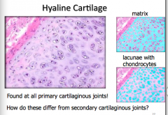 What type of cartilage forms cartilaginous joints?