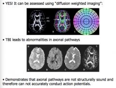 Can diffuse axonal injury (DAI) be assessed, non-invasively?