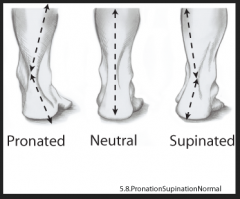 dorsiflexion is flexion of the ankle and elevation of the toes towards the shin "digging in your heels"
plantar flexion is the opposite...."pointing your toes"
eversion is twisting the foot that turns the sole outward
inversion turns the sole inward-->