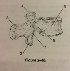 The number 2 in fig 2-40 represents which of the following structures 
A. Body
B. Pedicles
C. Inferior articular process
D. Superior articular process
