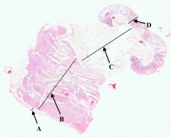 Muscularis Externa of colon