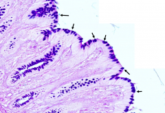 Why are Goblet cells abundant in this epithelium of the colon?